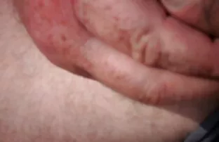 XXX وضع أصابع قدميه في المهبل وتمزيقه بكميات مقاطع فيديو سكسي يوتيوب كبيرة